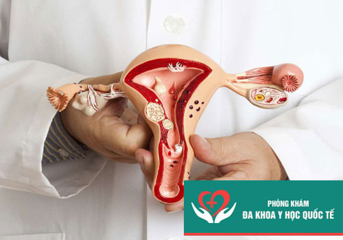 Ứ dịch tử cung sau khi phá thai